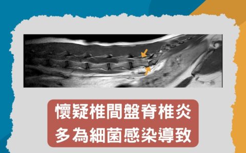 猫的尾巴突然不能动了？发现是猫椎间盘脊柱炎