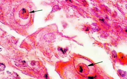 犬パルボウイルス症状および予防ガイド：嘔吐、下痢、脱水の特徴解説