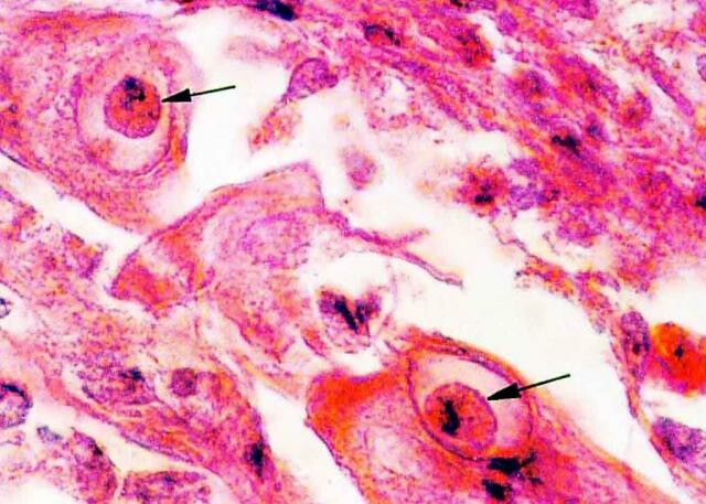 ペット犬の一般的な病気の診断と治療:イヌパルボウイルスの症状、診断および救命ガイド