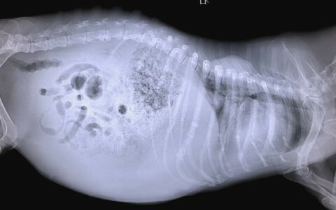 abdominal wall