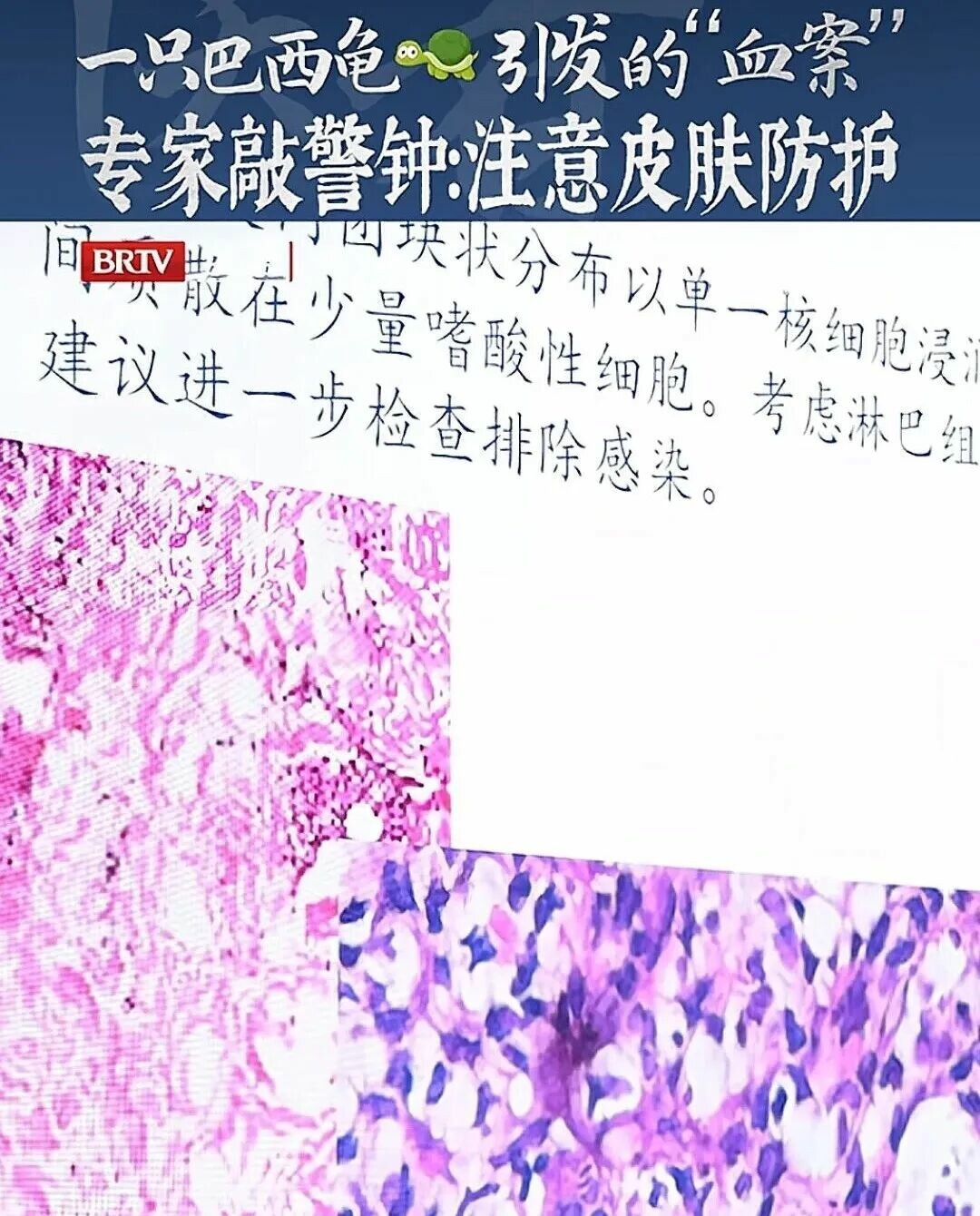 ミシシッピアカミミガメの水換え、手袋なしのリスクは?感染性肉芽腫の予防策(保存推奨)